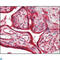 Calreticulin antibody, LS-C813350, Lifespan Biosciences, Immunohistochemistry paraffin image 