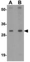 AP-3 complex subunit sigma-1 antibody, GTX31839, GeneTex, Western Blot image 