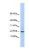 Family With Sequence Similarity 219 Member A antibody, NBP1-70482, Novus Biologicals, Western Blot image 