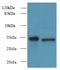 RWD Domain Containing 2A antibody, A60754-100, Epigentek, Western Blot image 