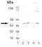 Protein Kinase CGMP-Dependent 1 antibody, A01708-2, Boster Biological Technology, Western Blot image 