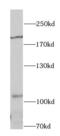 Insulin Receptor Substrate 1 antibody, FNab04400, FineTest, Western Blot image 