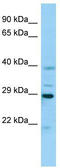 Cysteine Rich Secretory Protein 3 antibody, TA338135, Origene, Western Blot image 
