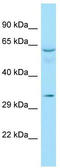 DNA repair protein RAD51 homolog 4 antibody, TA343160, Origene, Western Blot image 