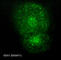 Early Endosome Antigen 1 antibody, EM3471, ECM Biosciences, Immunocytochemistry image 