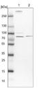 Mitogen-Activated Protein Kinase Kinase Kinase Kinase 5 antibody, NBP1-83385, Novus Biologicals, Western Blot image 
