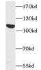 Reversion Inducing Cysteine Rich Protein With Kazal Motifs antibody, FNab07224, FineTest, Western Blot image 