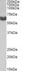 Anti-Mullerian Hormone Receptor Type 2 antibody, TA348938, Origene, Western Blot image 