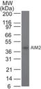 Absent In Melanoma 2 antibody, TA337162, Origene, Western Blot image 