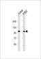 PR/SET Domain 16 antibody, M00782, Boster Biological Technology, Western Blot image 