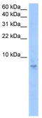 Septin-6 antibody, TA339323, Origene, Western Blot image 