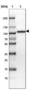 DNA-binding protein SATB2 antibody, NBP1-92365, Novus Biologicals, Western Blot image 