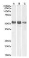 Alkaline Phosphatase, Biomineralization Associated antibody, orb382933, Biorbyt, Western Blot image 