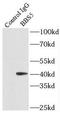 Bardet-Biedl Syndrome 5 antibody, FNab00819, FineTest, Immunoprecipitation image 