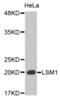 LSM1 Homolog, MRNA Degradation Associated antibody, abx004587, Abbexa, Western Blot image 