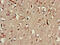 Mitogen-Activated Protein Kinase Kinase Kinase 13 antibody, CSB-PA013421LA01HU, Cusabio, Immunohistochemistry frozen image 