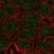 Envoplakin Like antibody, HPA045728, Atlas Antibodies, Immunocytochemistry image 