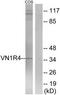 Vomeronasal 1 Receptor 4 antibody, TA316335, Origene, Western Blot image 
