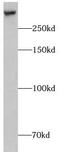 Chromodomain Helicase DNA Binding Protein 9 antibody, FNab01645, FineTest, Western Blot image 