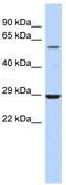 Lysophosphatidylcholine Acyltransferase 1 antibody, TA338682, Origene, Western Blot image 