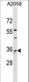 RAB40A, Member RAS Oncogene Family antibody, LS-C158791, Lifespan Biosciences, Western Blot image 