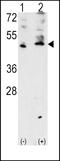 Vascular Endothelial Growth Factor C antibody, LS-C97706, Lifespan Biosciences, Western Blot image 
