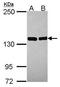 Valyl-TRNA Synthetase antibody, GTX115015, GeneTex, Western Blot image 