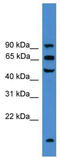 Tamm-Horsfall urinary glycoprotein antibody, TA346059, Origene, Western Blot image 