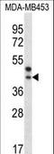 Palmitoyl-Protein Thioesterase 2 antibody, LS-C162102, Lifespan Biosciences, Western Blot image 