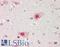 Karyopherin Subunit Alpha 6 antibody, LS-B14589, Lifespan Biosciences, Immunohistochemistry paraffin image 
