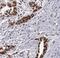 WT1 Transcription Factor antibody, FNab09528, FineTest, Immunohistochemistry paraffin image 