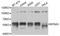 Karyopherin Subunit Alpha 3 antibody, A8347, ABclonal Technology, Western Blot image 