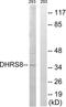 Hydroxysteroid 17-Beta Dehydrogenase 11 antibody, LS-C119900, Lifespan Biosciences, Western Blot image 