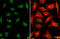 AT-Rich Interaction Domain 1A antibody, GTX129433, GeneTex, Immunofluorescence image 
