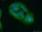 EPH Receptor A1 antibody, 18698-1-AP, Proteintech Group, Immunofluorescence image 