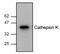 Cathepsin K antibody, AHP2292, Bio-Rad (formerly AbD Serotec) , Western Blot image 