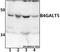 Beta-1,4-Galactosyltransferase 5 antibody, A09370-1, Boster Biological Technology, Western Blot image 