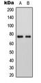 Alkaline Phosphatase, Placental antibody, LS-C354544, Lifespan Biosciences, Western Blot image 