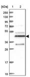 DERP5 antibody, PA5-58376, Invitrogen Antibodies, Western Blot image 