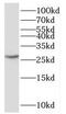 Small Nuclear Ribonucleoprotein Polypeptide N antibody, FNab08079, FineTest, Western Blot image 