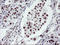 Ring Finger Protein 113B antibody, LS-C173653, Lifespan Biosciences, Immunohistochemistry paraffin image 