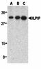 STE20 Related Adaptor Beta antibody, orb74517, Biorbyt, Western Blot image 