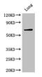 Baculoviral IAP Repeat Containing 3 antibody, CSB-PA623808LA01HU, Cusabio, Western Blot image 