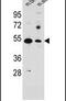 Solute Carrier Family 16 Member 11 antibody, PA5-24397, Invitrogen Antibodies, Western Blot image 