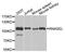 2-5A-dependent ribonuclease antibody, orb374266, Biorbyt, Western Blot image 