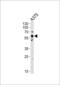 SRC Proto-Oncogene, Non-Receptor Tyrosine Kinase antibody, MBS9208706, MyBioSource, Western Blot image 