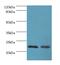 Anti-Silencing Function 1A Histone Chaperone antibody, MBS1492743, MyBioSource, Western Blot image 