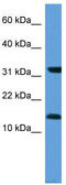 Microsomal Glutathione S-Transferase 3 antibody, TA342918, Origene, Western Blot image 
