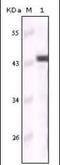 Keratin 5 antibody, orb88953, Biorbyt, Western Blot image 