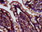 Cerebellar degeneration-related protein 2-like antibody, LS-C671831, Lifespan Biosciences, Immunohistochemistry paraffin image 